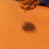 clipThumbnail
