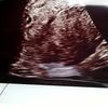 clipThumbnail