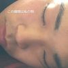 clipThumbnail